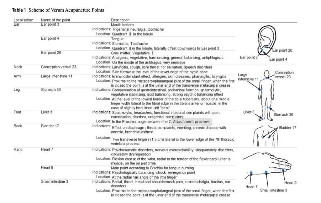 Diagram showing the acupuncture points used in the study on Burning Mouth Syndrome, including locations on the ear, neck, arm, leg, back, and hand.